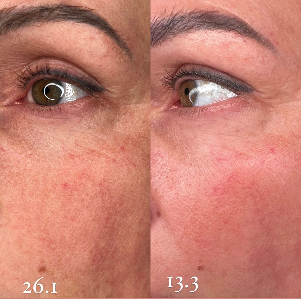 Peptilux Anti-Falten-Augencreme mit TIBOTOH-X™